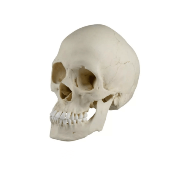 Skaphozephaler Schädel – anschauliches Modell einer Schädeldeformation durch vorzeitige Nahtverknöcherung - Erler - Zimmer